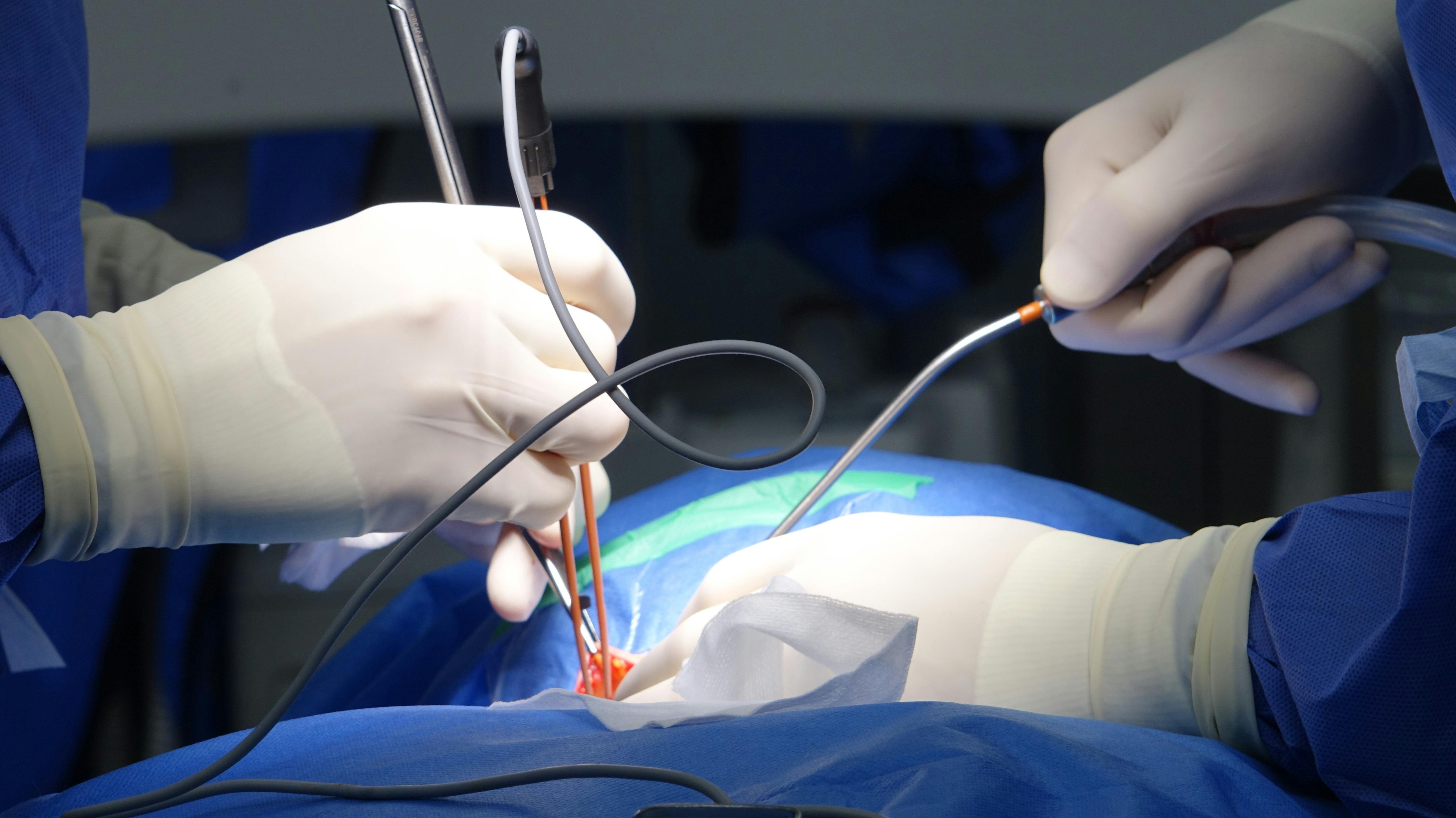 Advanced Minimally Invasive Surgery in Progress